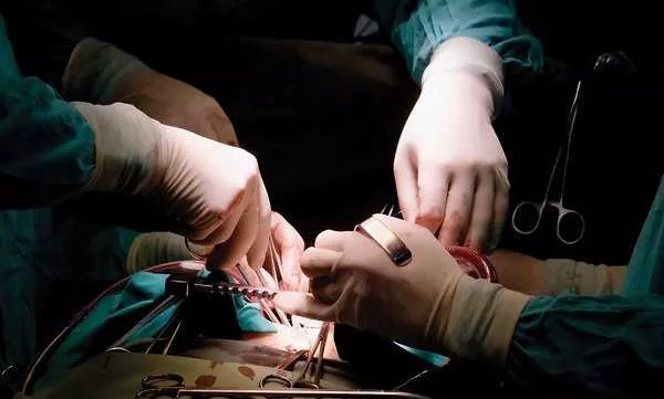 Espianto multiorgano al Cardarelli di Campobasso ridona speranza a 4 persone