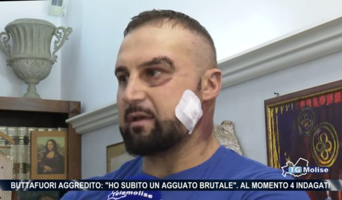 Parla il buttafuori aggredito: “Ho temuto il peggio, ho subito un agguato brutale”
