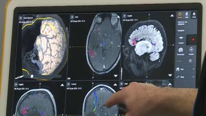 Rete Ictus, Tar rigetta richiesta sospensiva di associazioni e comune Campobasso